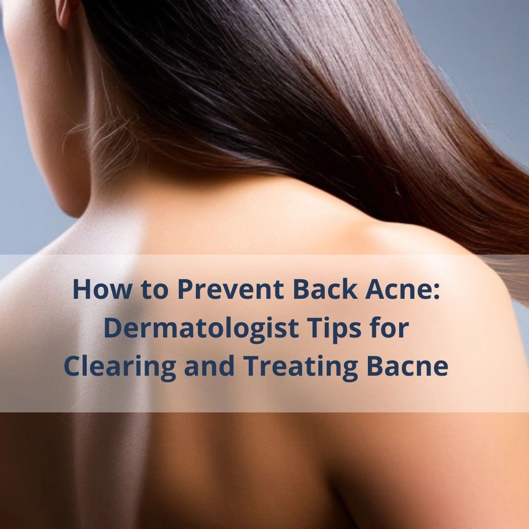 How to Prevent Back Acne Tips from Dermatologist